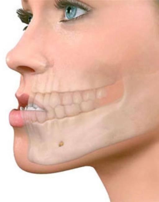 cirugía oral y maxilofacial