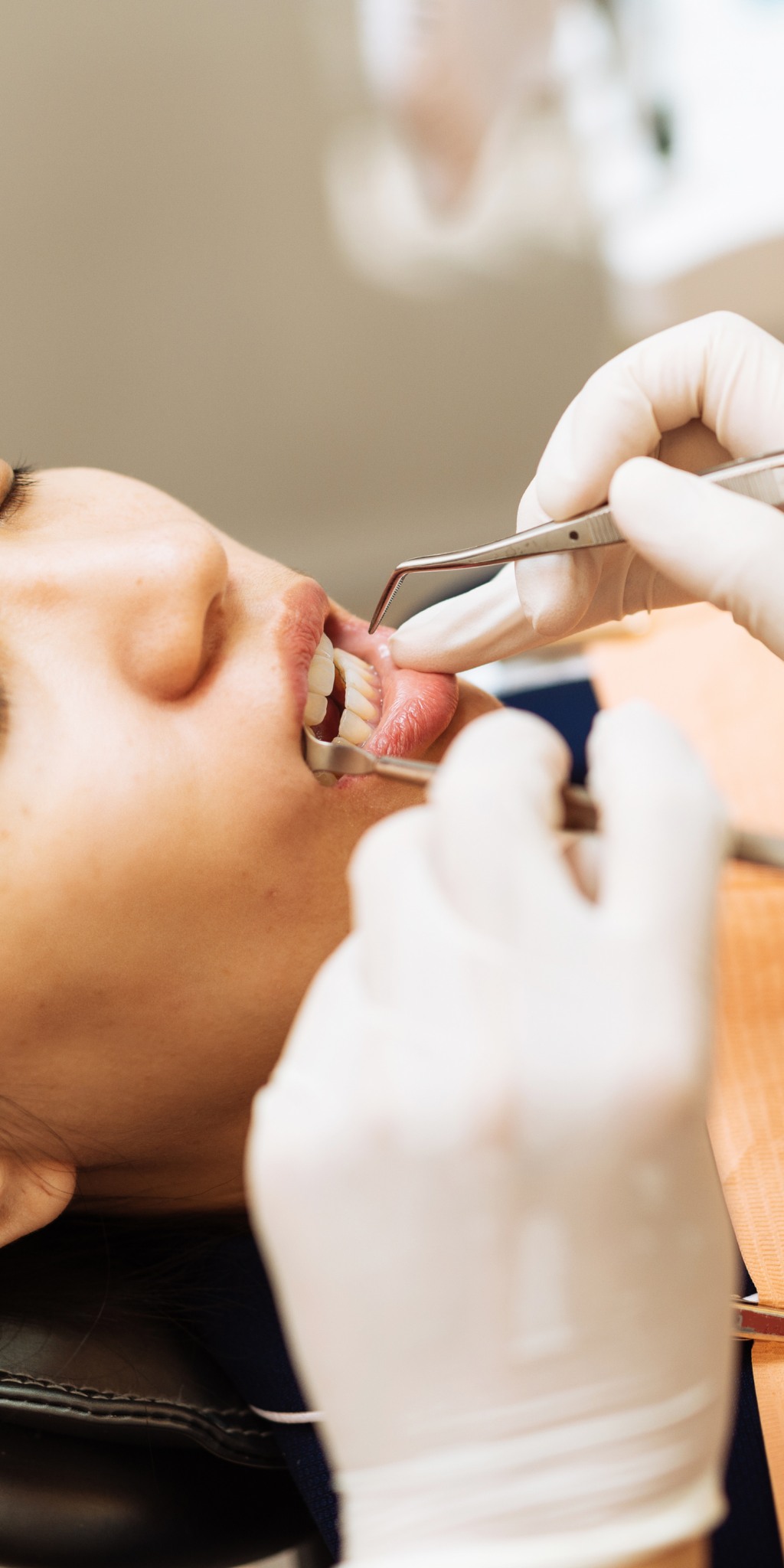 ¿qué Es La Periodoncia Beneficios Clínica Kranionemk 4677