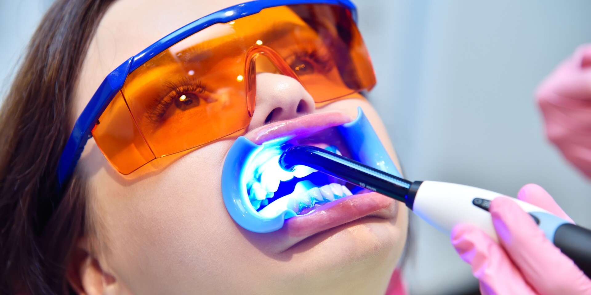 blanqueamiento dental