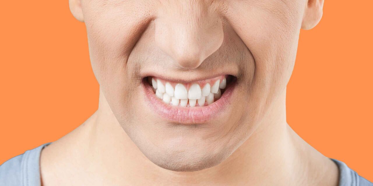 bruxismo