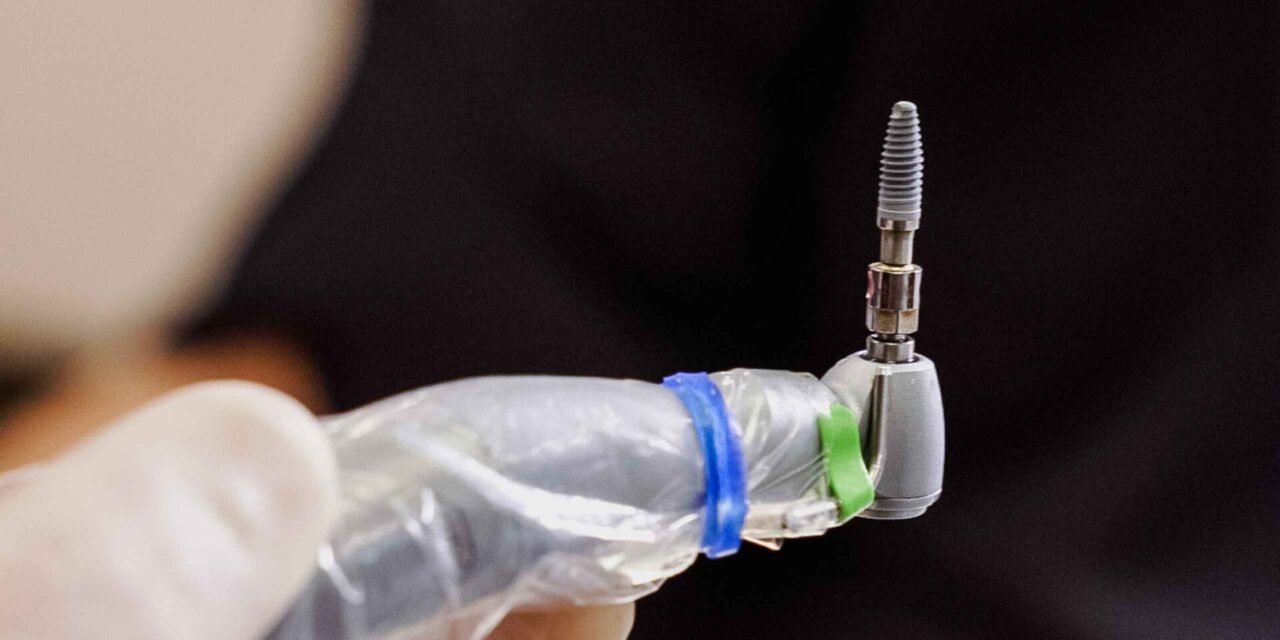 implantes dentales