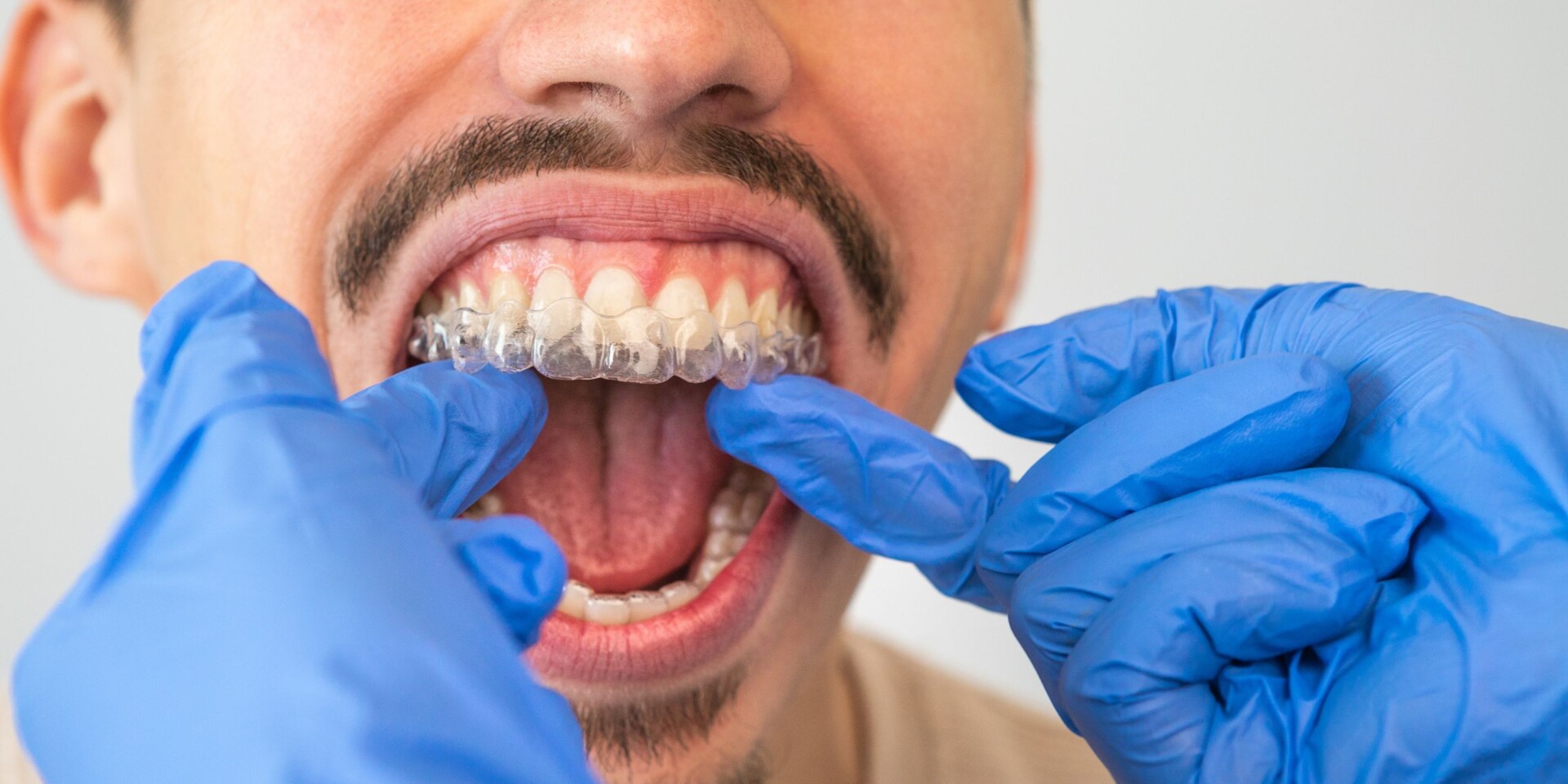 ortodoncia invisible