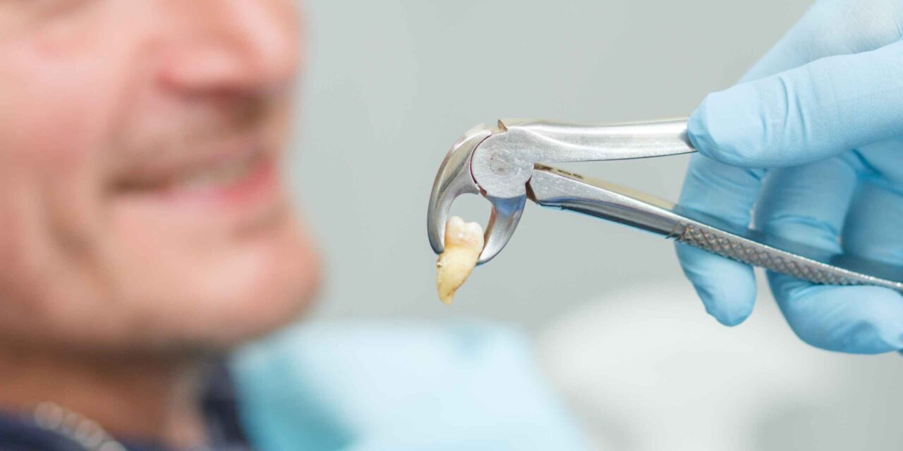 extracción dental