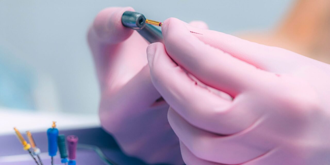 Tratamiento de conducto. Endodoncia en Alicante