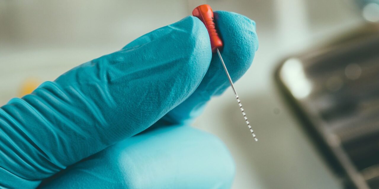Tratamiento de conducto. Endodoncia en Alicante
