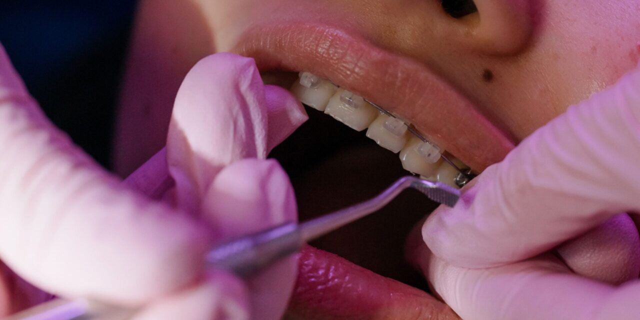 brackets invisibles