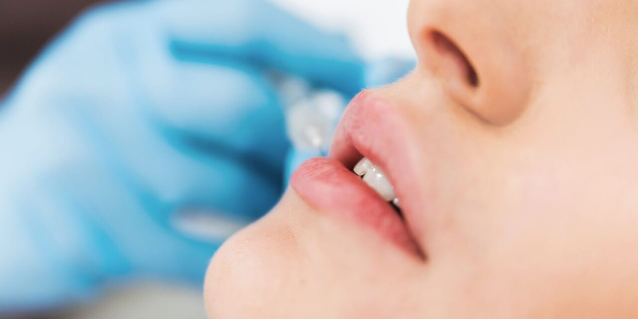 Ácido Hialurónico Labios