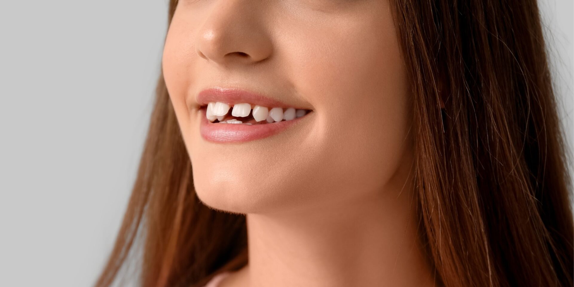 diastema dental