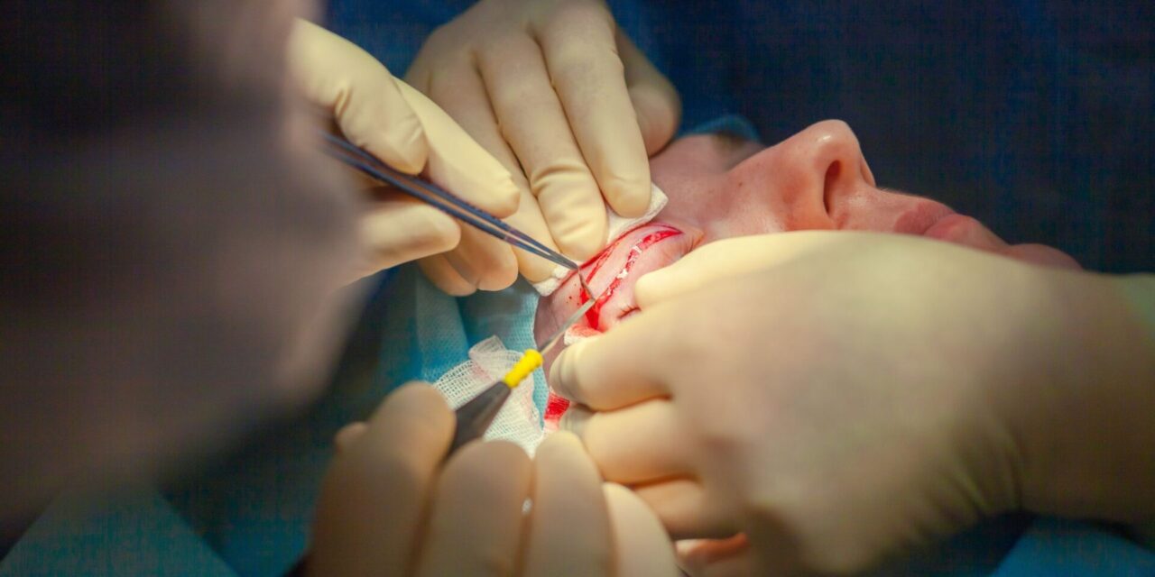 Blefaroplastia Superior