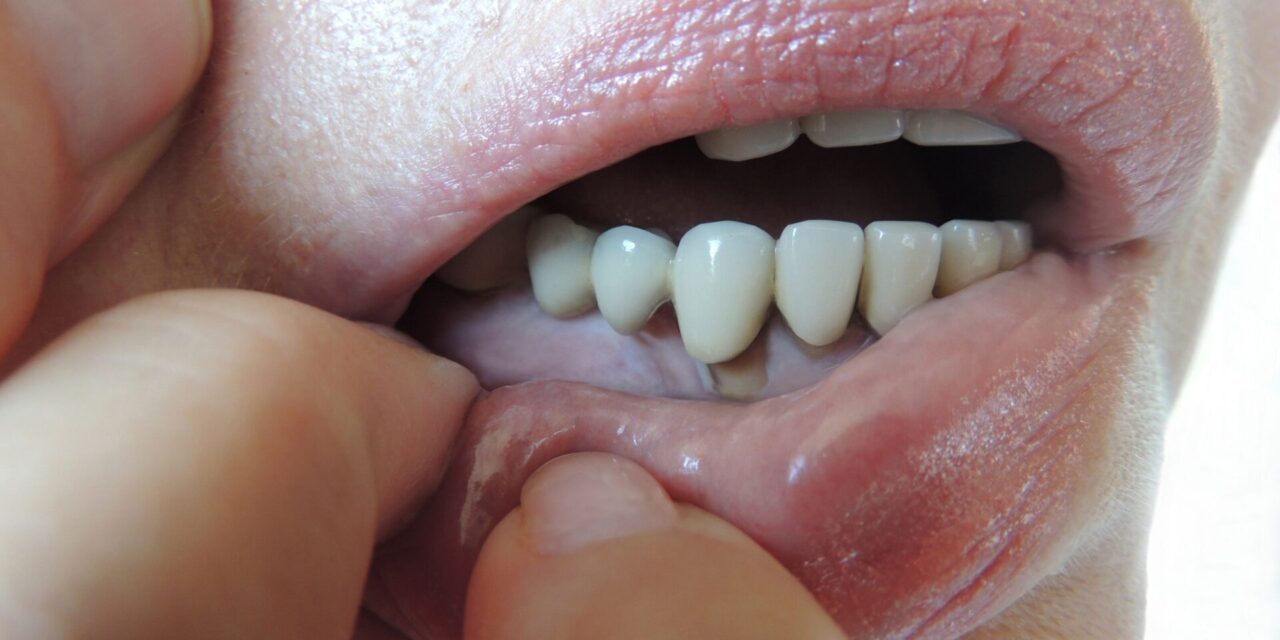periodoncia