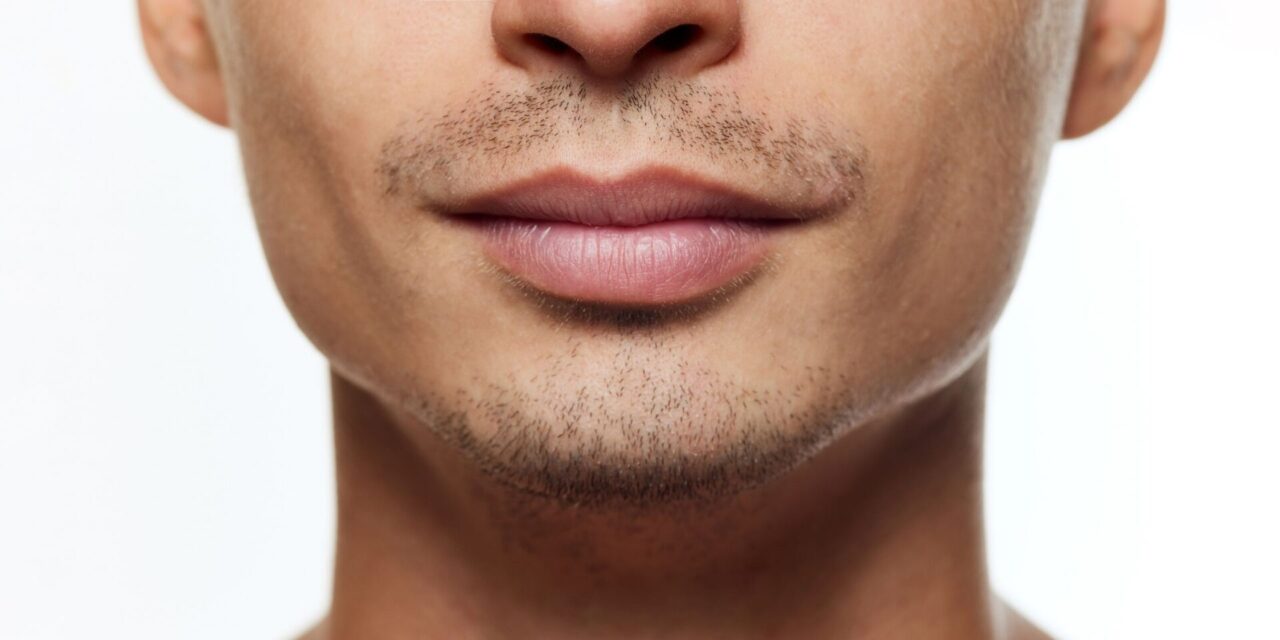 Prótesis de Ángulos Mandibulares