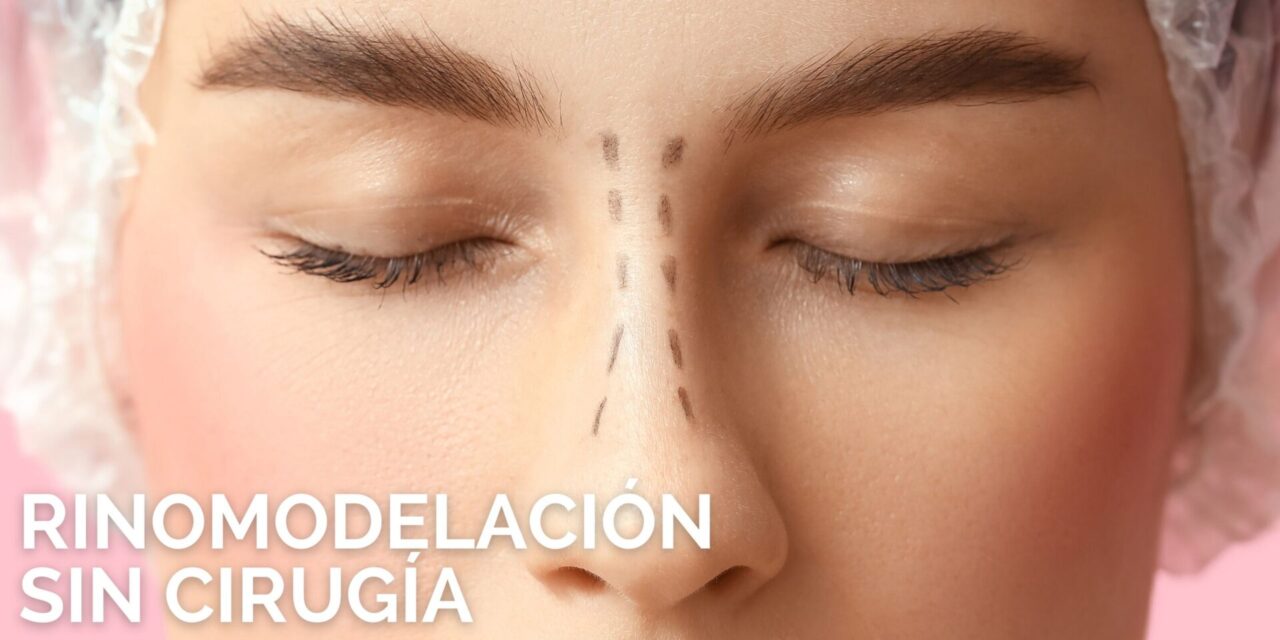 RINOMODELACIÓN SIN CIRUGÍA