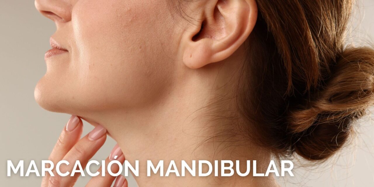 marcación mandibular