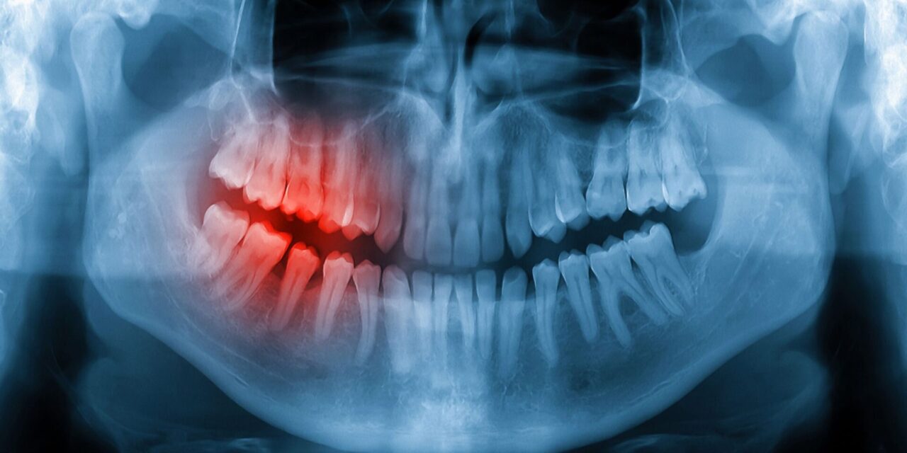 emergencias dentales
