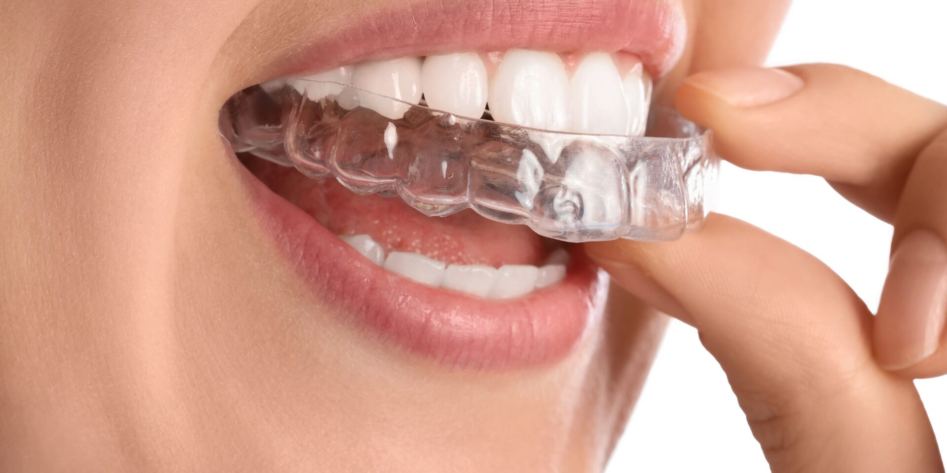 brackets invisibles