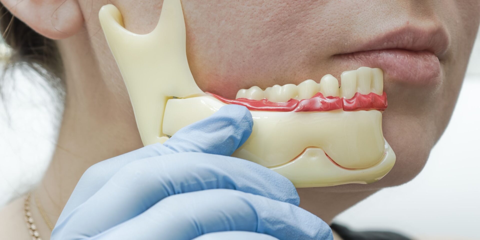 cirugía ortognática