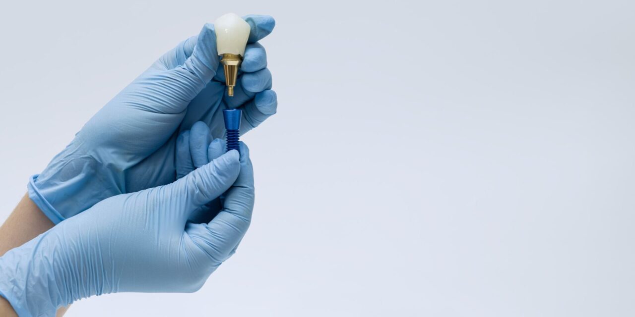 injerto dental