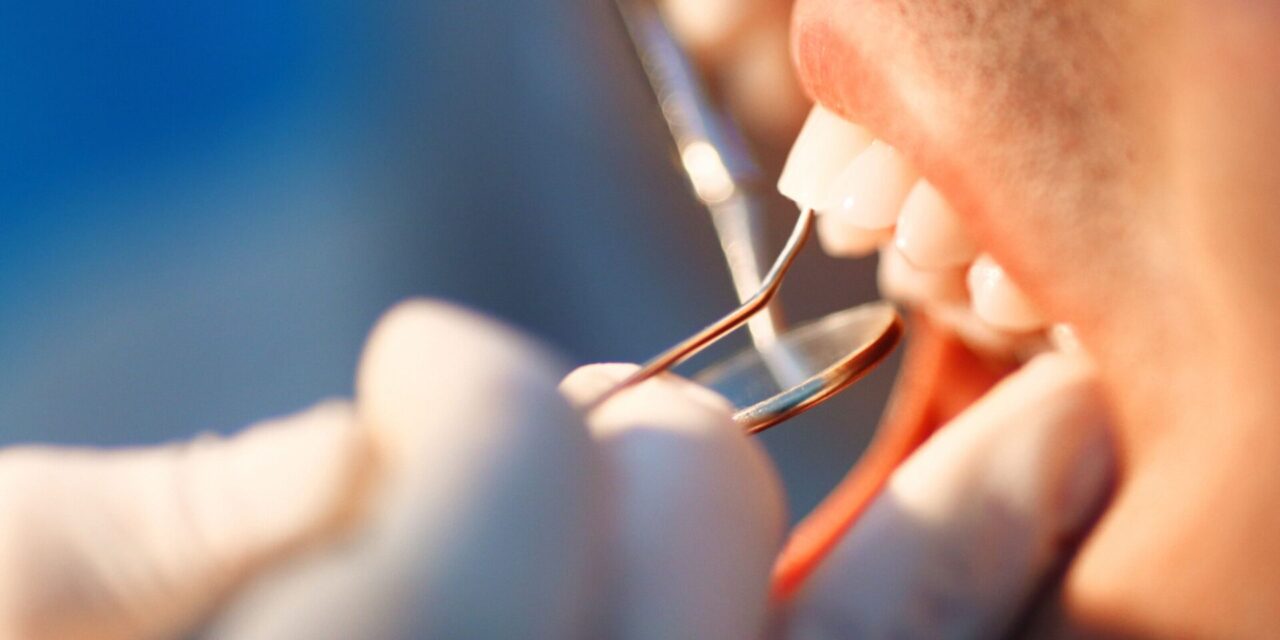 injerto dental