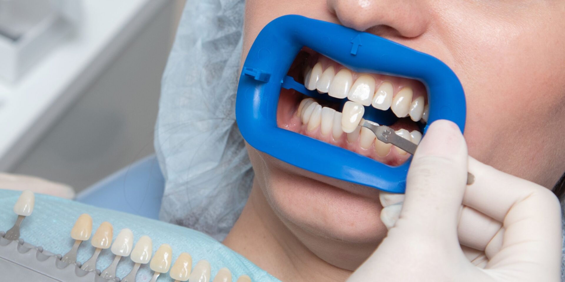 carilla dental