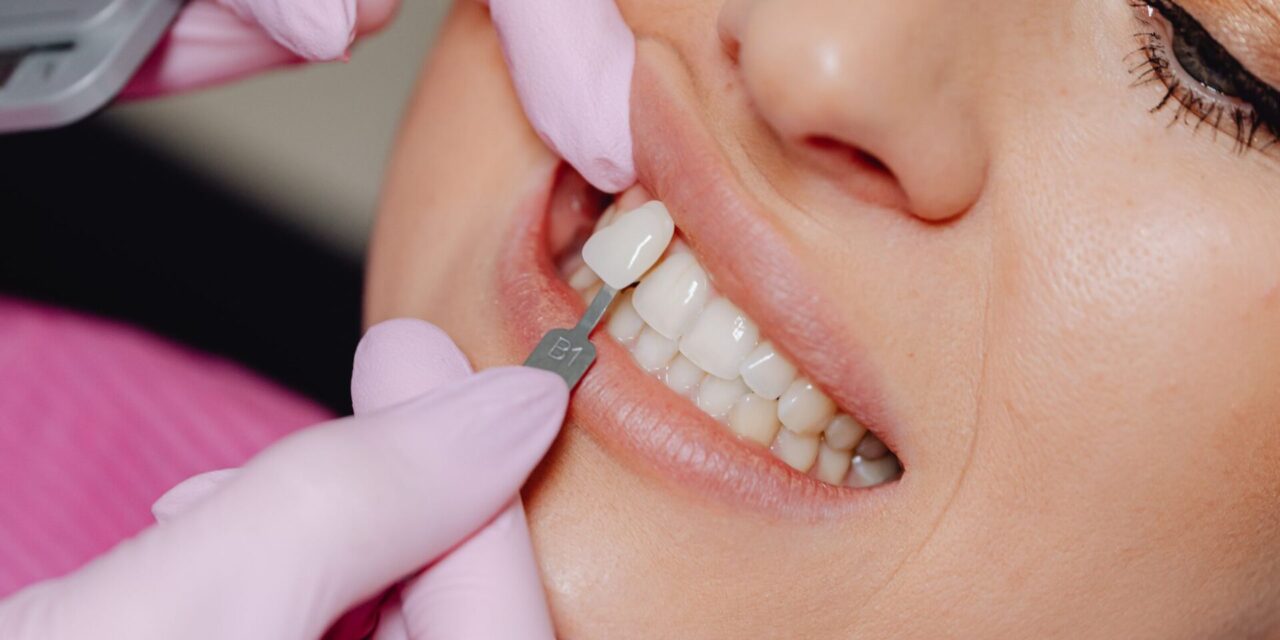 carilla dental