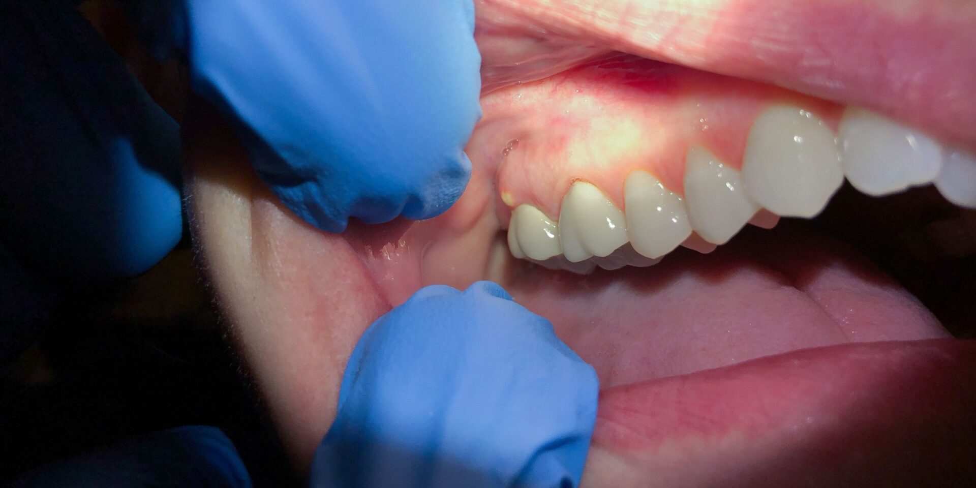 urgencia dental