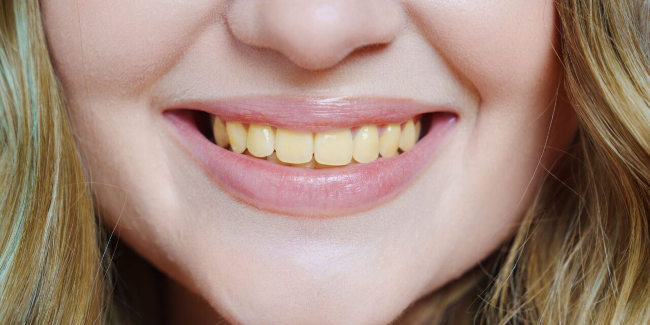 dientes amarillos