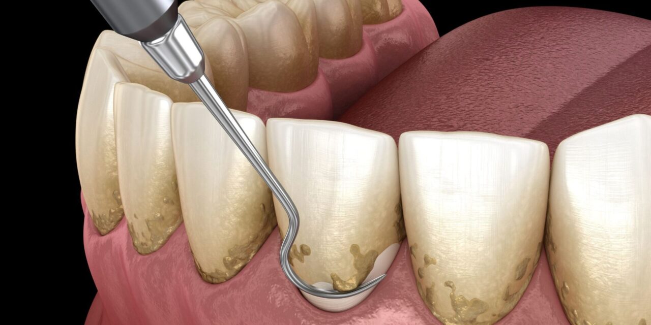 enfermedades dentales